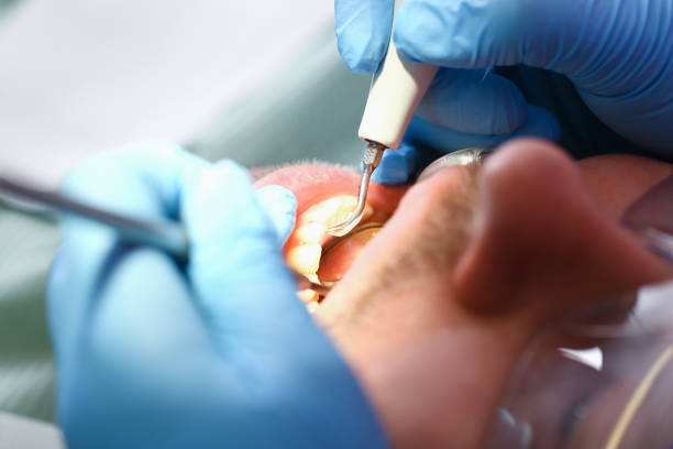 Best Emergency Treatment for Oral Infections in Blue Ridge, AL